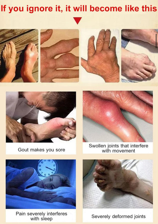 Propolis Professional Treatment Gel - Radimiss store